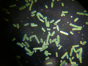 Spirulina-Algen unter dem Mikroskop
